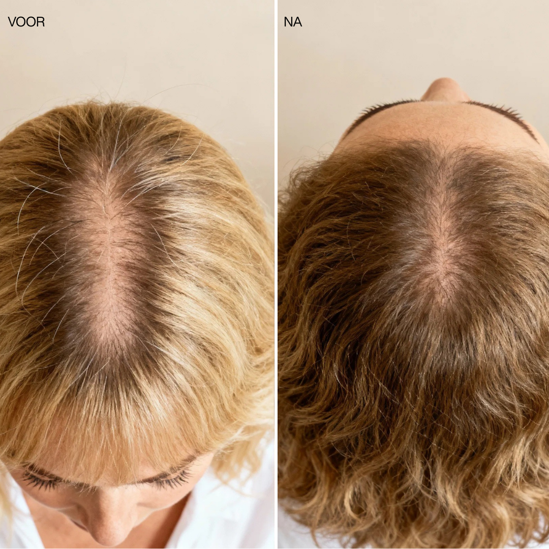 Haargroei Olie - TEST VROUW